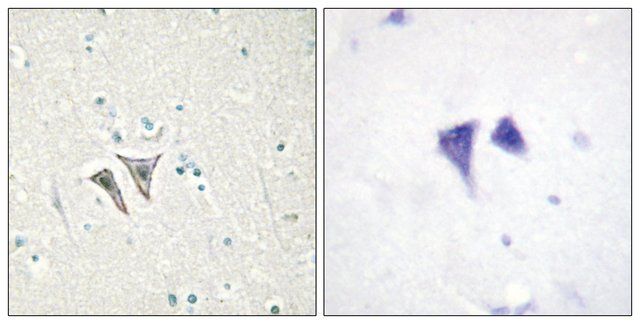 Anti-ACTR-1C antibody produced in rabbit