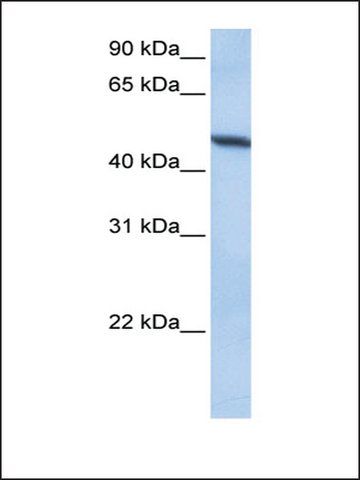 Anti-ADAM33 antibody produced in rabbit