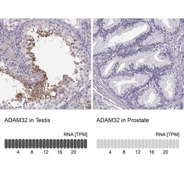 Anti-ADAM32 antibody produced in rabbit