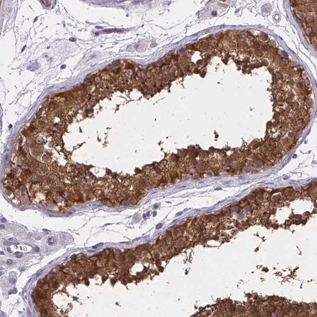 Anti-ADAMTSL1 antibody produced in rabbit