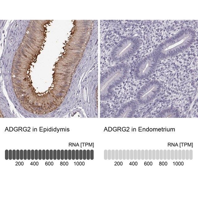 Anti-ADGRG2 antibody produced in rabbit