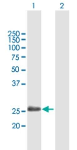 Anti-ADH6 antibody produced in mouse