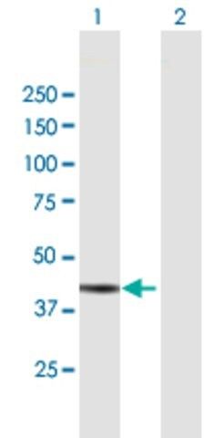 Anti-ADH7 antibody produced in mouse