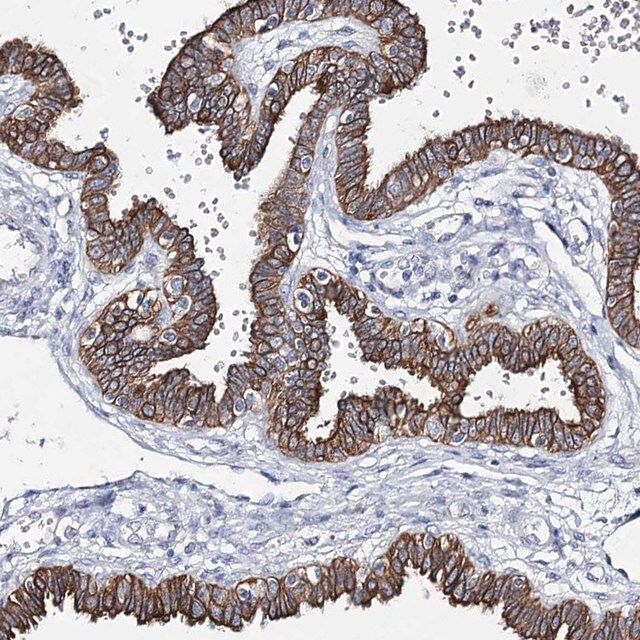 Anti-ADGRL1 antibody produced in rabbit