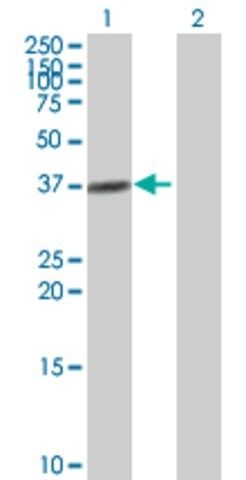 Anti-ADH4 antibody produced in mouse