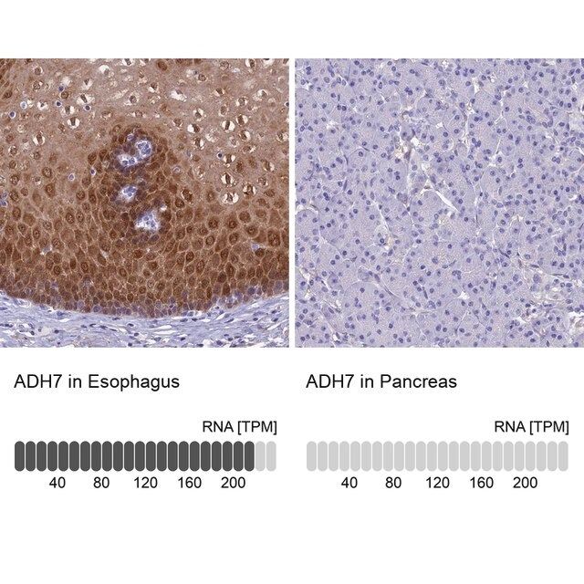 Anti-ADH7 antibody produced in rabbit