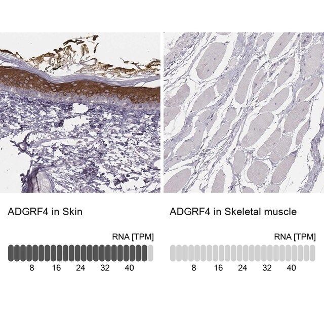 Anti-ADGRF4 antibody produced in rabbit