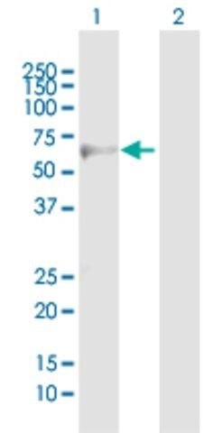 Anti-ADRB3 antibody produced in mouse