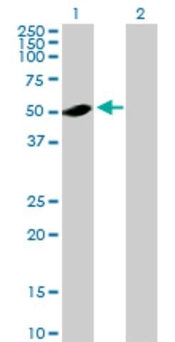 Anti-ADSL antibody produced in mouse