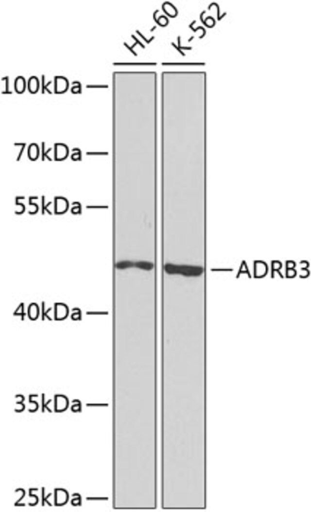 Anti-ADRB3 antibody produced in rabbit