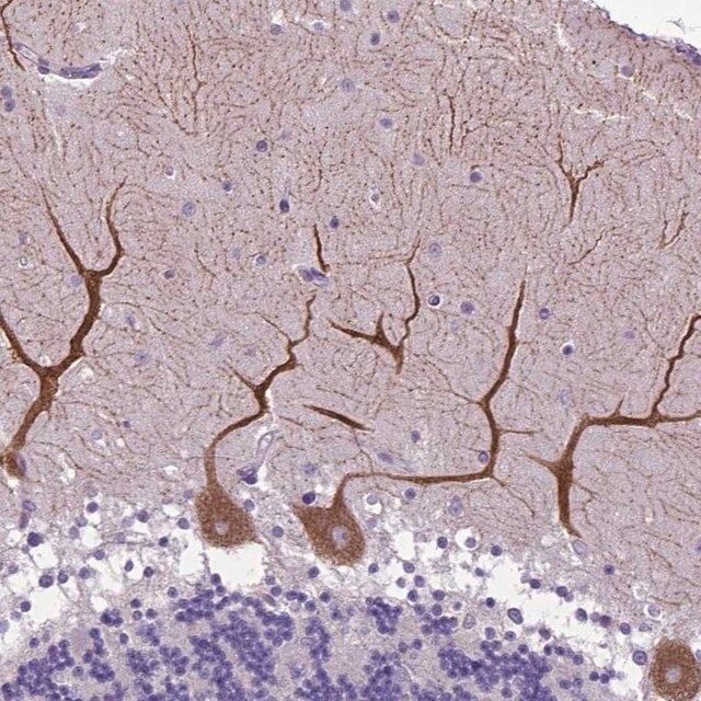 Anti-ADRA2B antibody produced in rabbit