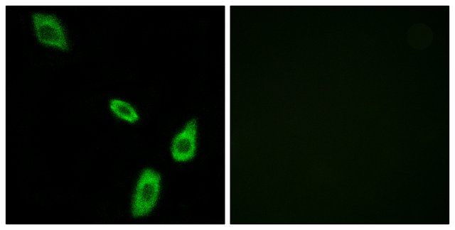 Anti-ADRA1B antibody produced in rabbit