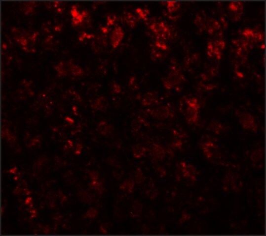 Anti-AFP antibody produced in rabbit