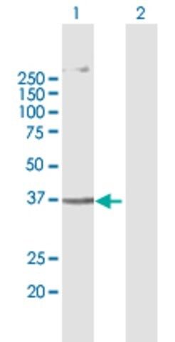 Anti-AGPAT5 antibody produced in mouse