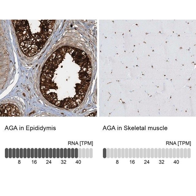 Anti-AGA antibody produced in rabbit