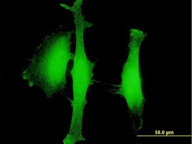 Anti-AGBL5 antibody produced in mouse