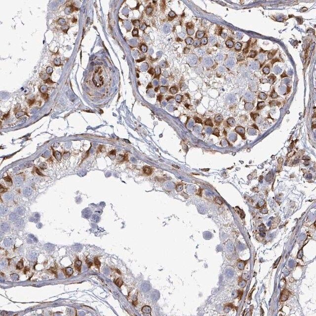 Anti-AGAP1 antibody produced in rabbit