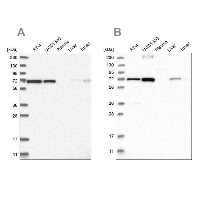 Anti-AGPS antibody produced in rabbit