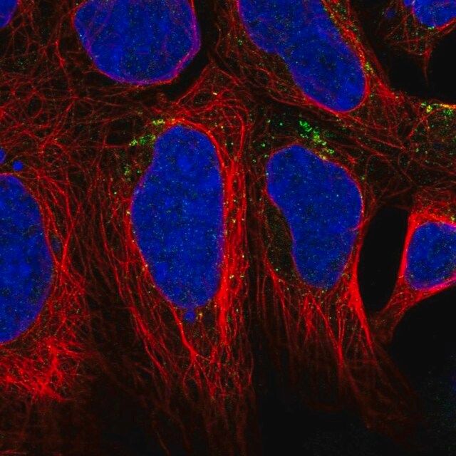 Anti-AGPAT4 antibody produced in rabbit