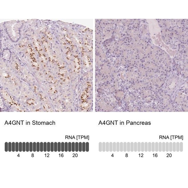 Anti-A4GNT antibody produced in rabbit