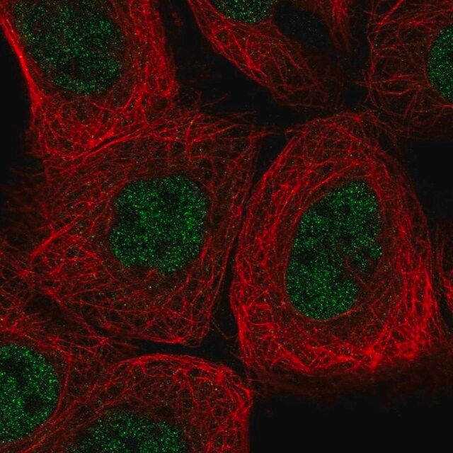 Anti-AGL antibody produced in rabbit