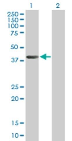 ANTI-AHCY antibody produced in mouse