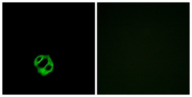 Anti-AGTRL1 antibody produced in rabbit