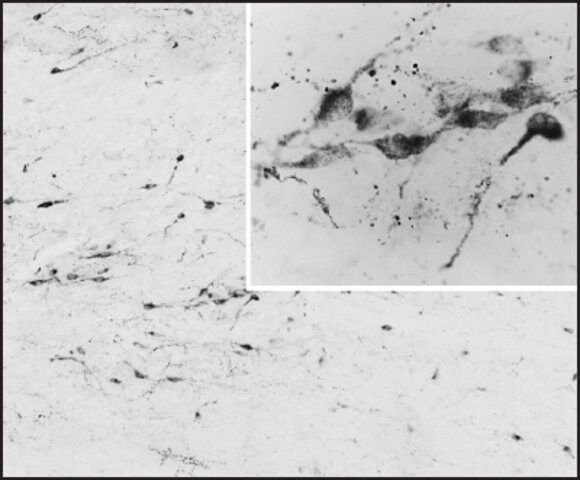 Anti-AGRP (C-terminal) antibody produced in goat