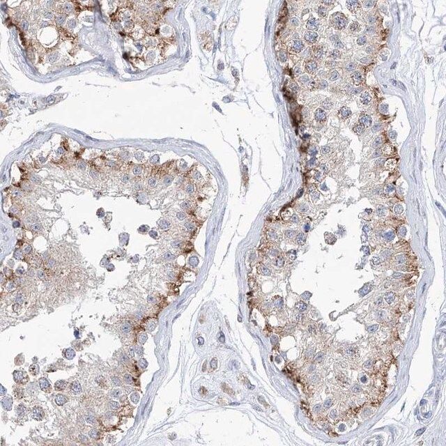 Anti-AGPS antibody produced in rabbit