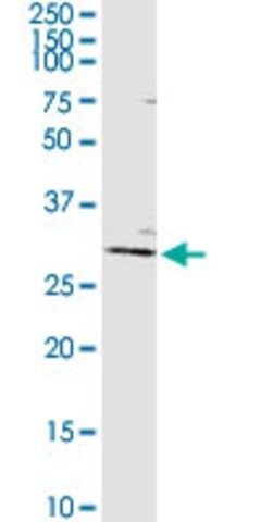 Anti-AGPAT2 antibody produced in rabbit