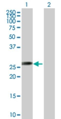 Anti-AGPAT1 antibody produced in mouse