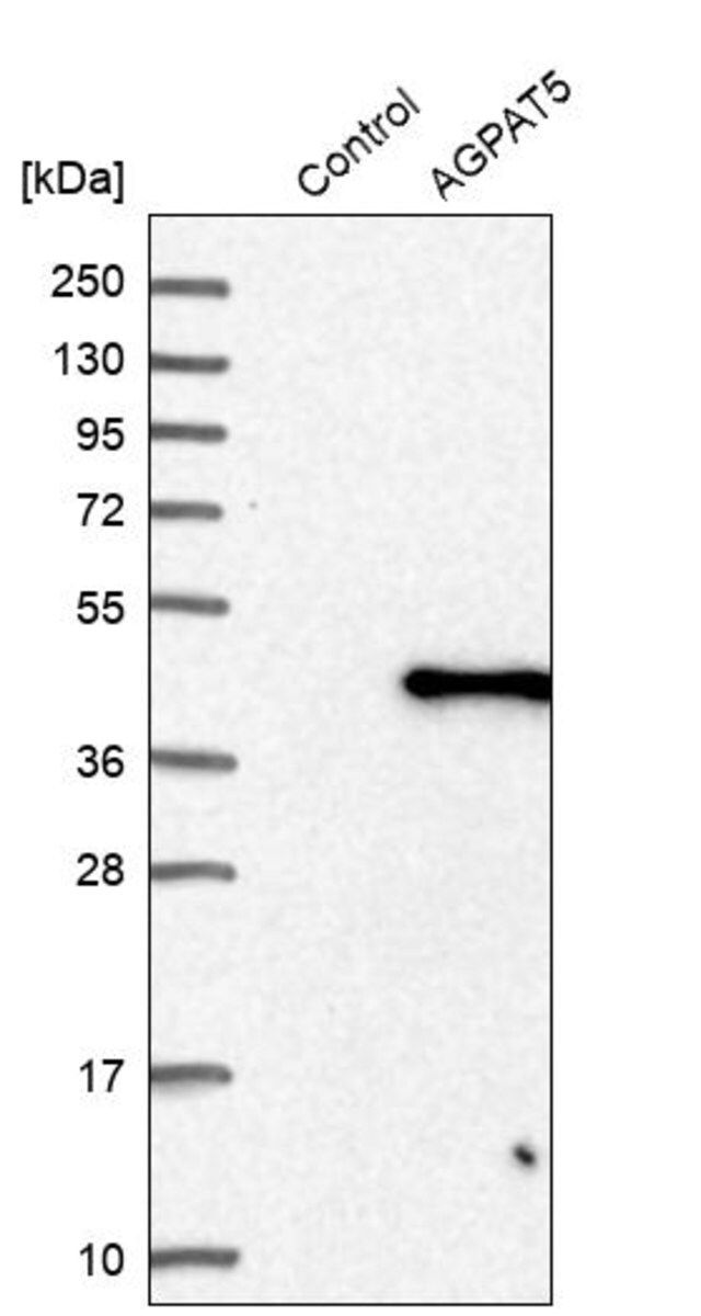 Anti-AGPAT5 antibody produced in rabbit