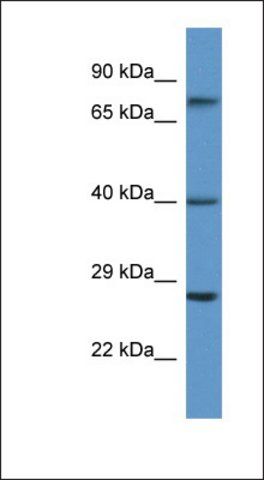 Anti-AGTR2 antibody produced in rabbit