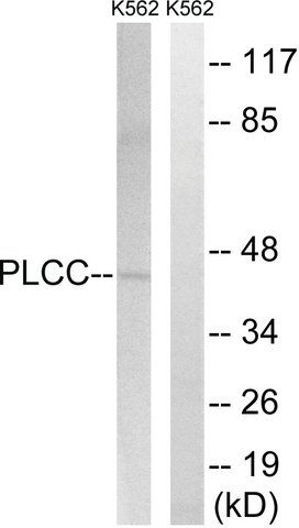 Anti-AGPAT3 antibody produced in rabbit