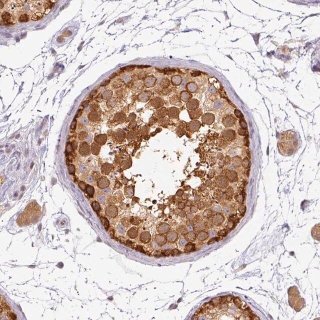 Anti-AGPAT4 antibody produced in rabbit