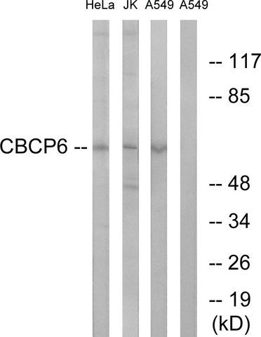 Anti-AGBL4 antibody produced in rabbit