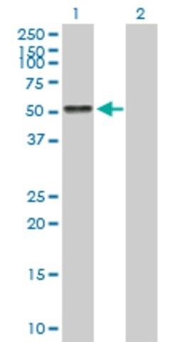 Anti-AGT antibody produced in mouse