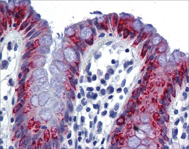 Anti-AGR2 antibody produced in rabbit