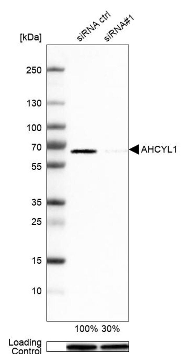 Anti-AHCYL1 antibody produced in rabbit