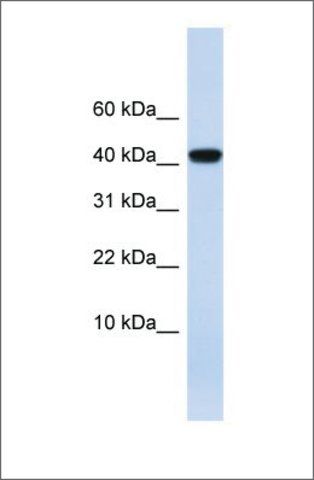 Anti-AGT antibody produced in rabbit