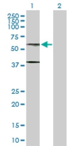 Anti-AHCYL1 antibody produced in rabbit