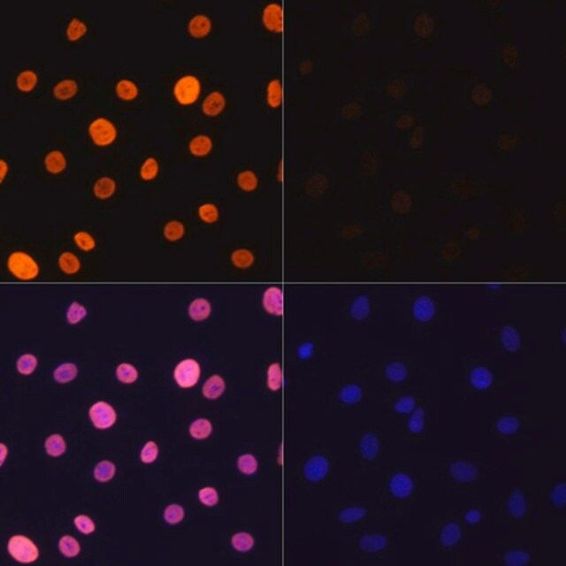 Anti-Acetyl-Histone H3-K4 antibody produced in rabbit