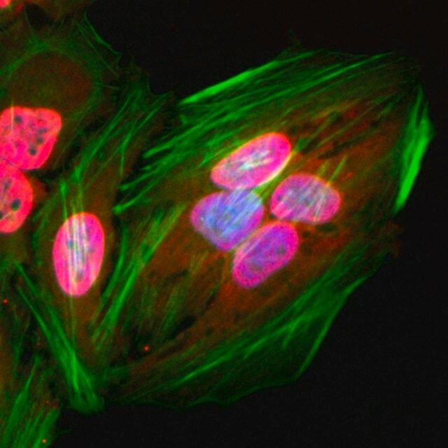 Anti-Acetylated-Lysine antibody, Rabbit monoclonal