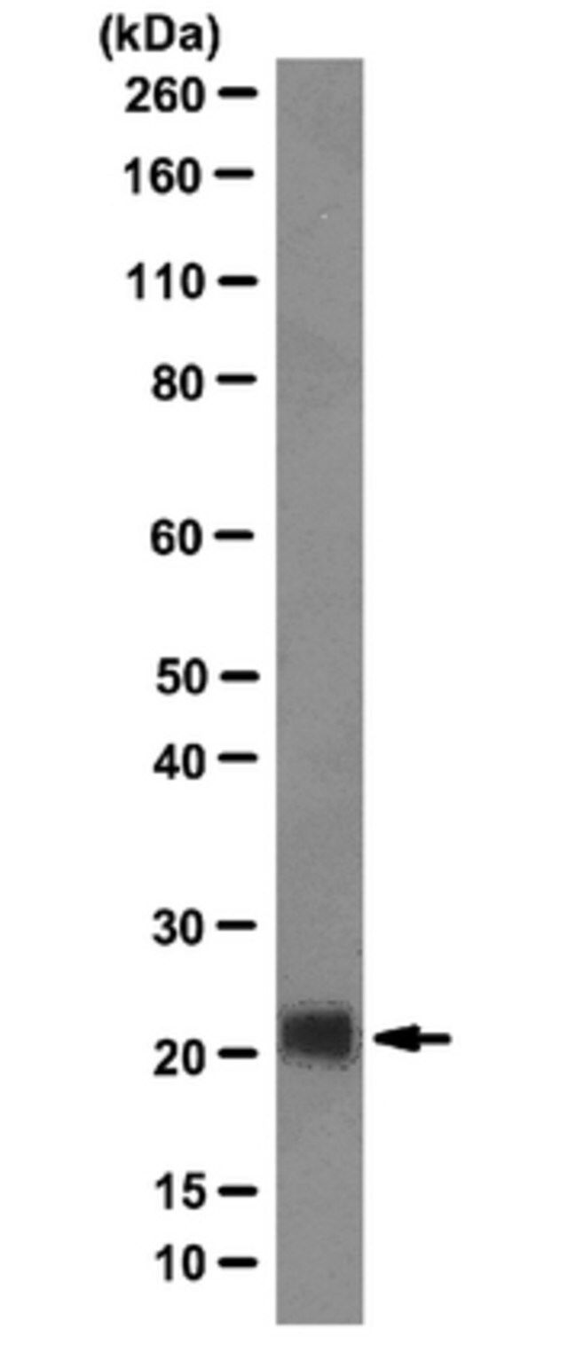 Anti-Achaete Scute homolog 2 Antibody, clone 8F1