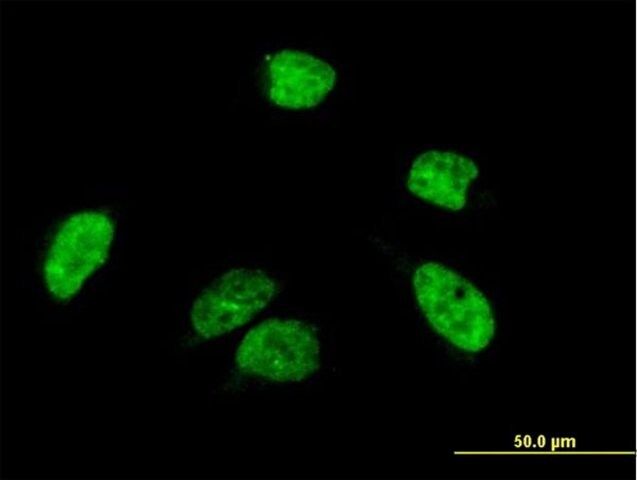 Anti-A1CF antibody produced in mouse