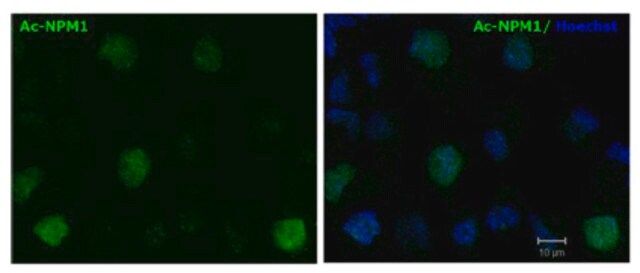 Anti-Acetylated Nucleophosmin Antibody, clone 31M1