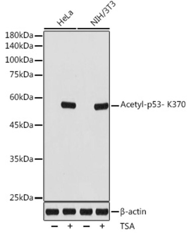 Anti-Acetyl-p53- K370 antibody produced in rabbit