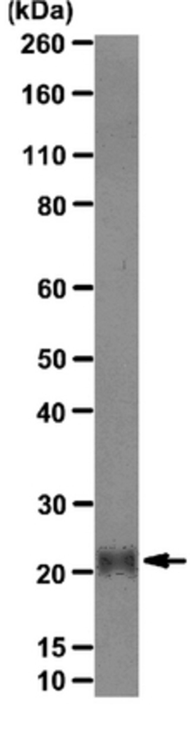 Anti-Achaete Scute homolog 2 Antibody, clone 7E2