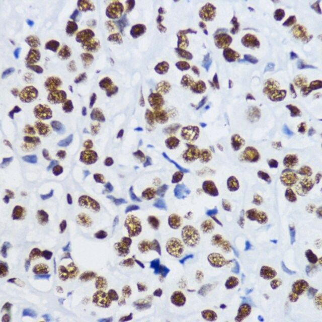 Anti-Acetyl-Histone H3-K9 antibody produced in rabbit