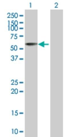 Anti-ACP6 antibody produced in mouse